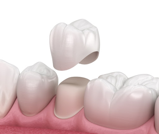Cosmetic dentistry in Ithaca, NY