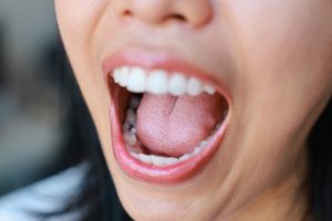 Close-up of a person's open mouth showing healthy teeth and tongue, highlighting oral health relevant to dental filling candidacy evaluations.