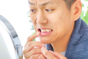 man looking at teeth, worried